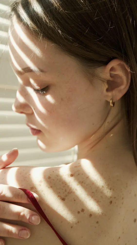 A woman with freckles in her back shoulder